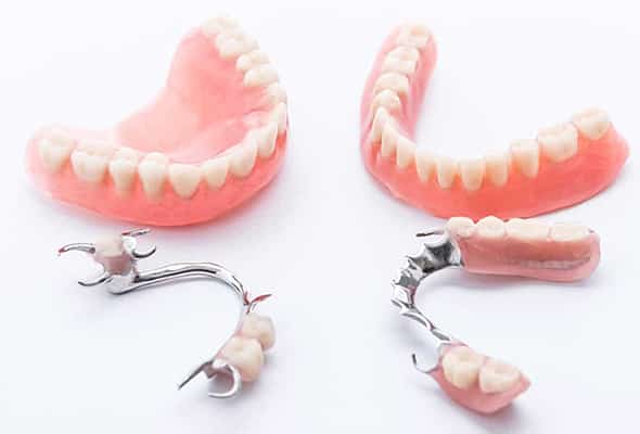 Bild von vier Prothesen und Zahnersatz - Modellguss
