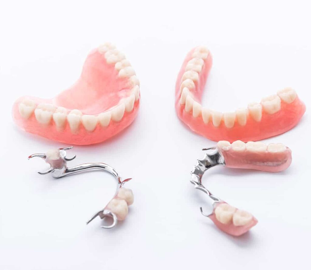 Bild von vier Prothesen und Zahnersatz - Modellguss